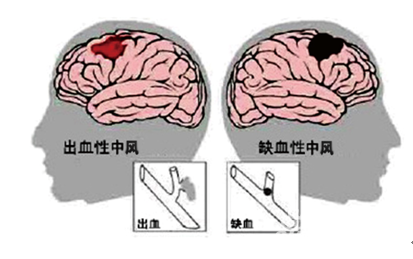 &#29699;&#36895;&#20307;&#32946;&#24179;&#21488;&#45;&#29699;&#36895;&#65288;&#20013;&#22269;&#65289;